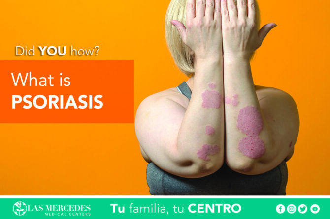 What Is Psoriasis?